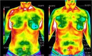 Earthing and Thermal Image Skin